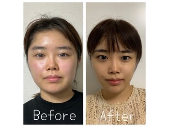 ルビー 池袋店(Ruby)/小顔矯正×マシン学生割引