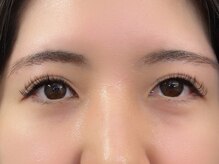 スキン 心斎橋店(skin)/LEDダブルフラットエクステ