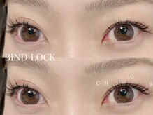 リジェネ(Regene)/バインドロック80束