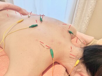 からだとこころ 恵比寿/背中のこり