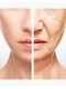 エムイーボーテ(me.Beaute)の写真/【最短×最速  肌質改善ケア】ソフトピーリングで肌底からハリを与えてシワたるみ改善！継続で予防◎