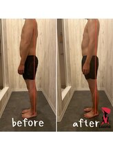 ルアナ(Luana)/オールハンド筋膜リリース