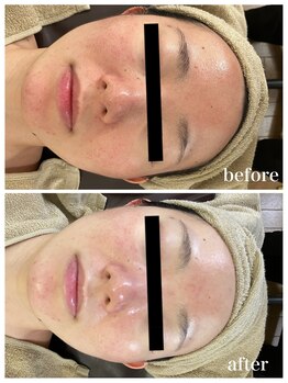 ジャスミン(Jasmin)/オーダーメイド高濃度原液導入