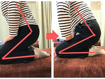 杉本接骨鍼灸院/膝の症状例:施術を受けた方の声