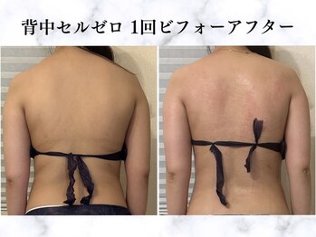 シーフェイス 横浜店(SEE FACE)/選べる1部位マシーン体験