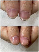 ラヴィネイル(La Vie Nail)/ネイルケア/美フォルム形成/爪育