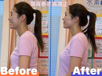 ヒデ整体院(Hide整体院)/首こり肩こり猫背巻き肩骨盤矯正