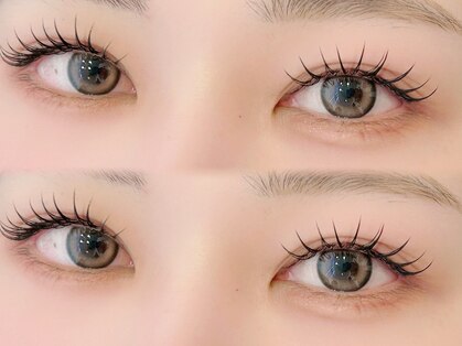 リュネル(Lunelle)の写真
