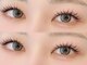 リュネル(Lunelle)の写真