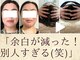 スウ(suu.)の写真/ダウンタイム一切なし！痛みは最小！骨格バランスが整うだけでこんなに変わる☆髪型を選ばない小顔美人へ♪
