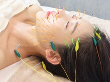 ハリックマ(HARICCUMA)/【人気No1】小顔美容鍼