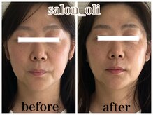 サロン オリ(salon_oli)の雰囲気（凹凸のない美しい輪郭を造る！顔ひと回り分の変化！）