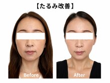 クローバー(clover)の雰囲気（小顔ケアでたるみを整え引き締まった横顔へ）