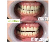 ルブラン 奈良店(Le Blanc)/その黄ばみ！！