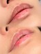Ｓｔｕｄｉｏ Ｍｉｌｅｎａ Ｓｈｉｎｏｚａｋｉ　【ローマピンク】の写真/【ローマピンク導入】デリケートゾーン・唇の黒ずみを集中ケア！透明感溢れる素肌へ導く最新美白ケア★