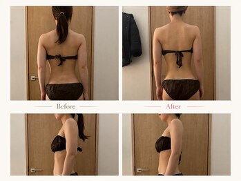 リュクスアンドコー 上田店(Luxe&co.)の写真/【挙式・前撮りに向けたブライダルシーンに☆】結果重視であなた史上1番の綺麗を叶えます♪