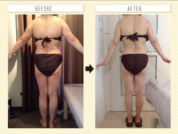 美容整体ウェリナ あま甚目寺院/小顔矯正/骨盤矯正/美脚サロン