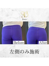ルーツ(R∞ts)/お尻の大きさも♪