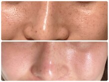 レクシートーキョー(LEXXXY TOKYO)/あらゆるお悩みに◎