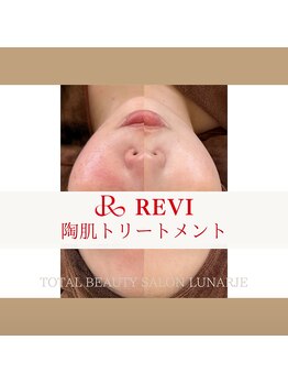 ルナージュ(LUNARJE)/陶肌トリートメント