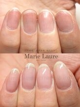 マリーロール 天王寺店(Marie Laure)/深爪矯正/自爪育成/ネイルケア/