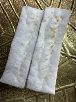 グリーン(green)/毛穴の詰まり!!