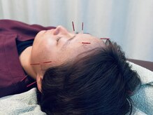 やぎ鍼灸接骨院 志木院の雰囲気（鍼灸施術や美容鍼も当院でご利用いただけます。）