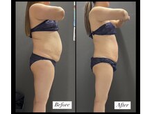 エムズビューティーサロン(M's Beauty Salon)/お客様Before After