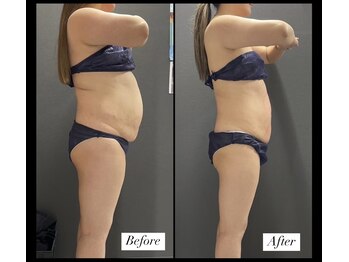 エムズビューティーサロン(M's Beauty Salon)/お客様Before After