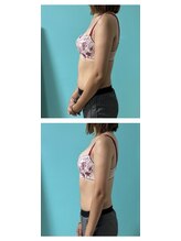 ネイト ワックス(Neit Wax)/バストアップ【側面】