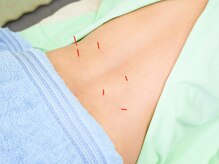 キュアハンズ 大森の雰囲気（腰痛に効果的な鍼。）