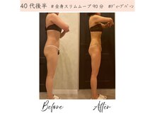 Melrose 銀座店　【メルローズ】/【お客様の効果写真】