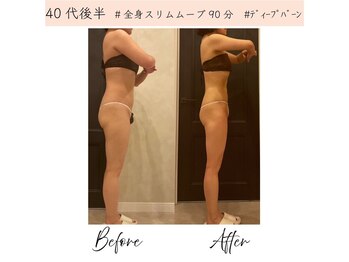 Melrose 銀座店 【メルローズ】/【お客様の効果写真】