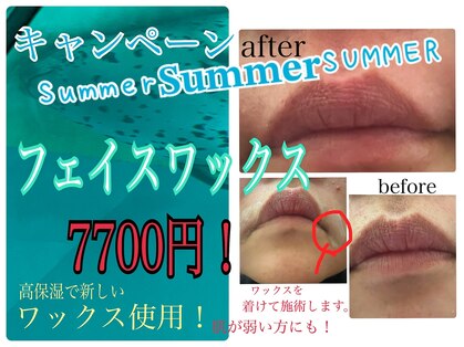 ルーナ(Luna)の写真