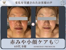 サムデイ プレミアム 池袋店(SOMEDAY PREMIUM)/FACE