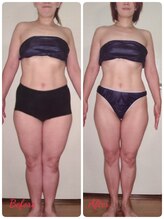 ダイエットルーム リ ボーヌ(Re Bornu)/・40代　全身メディセル16回