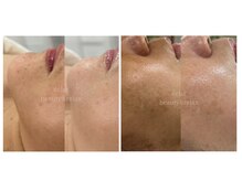 エクラ(eclat)の雰囲気（before/after）
