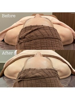 美容整体 レナトゥス 武庫之荘(Renatus)/フェイシャルだけど姿勢改善