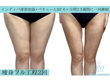 リメイク 広尾(REMAKE)/