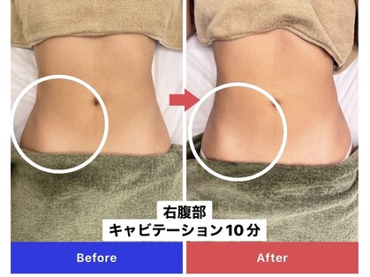 エトワール(etoile)の写真