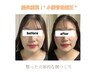 snow drop式【小顔骨格矯正】¥5,000→ご新規¥4,000