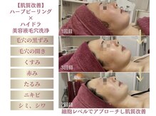 GRACETHOUSAND(グレイスサウザンド)の雰囲気（西宮/甲子園口/ハーブピーリング/毛穴/フェイシャル/ニキビケア）