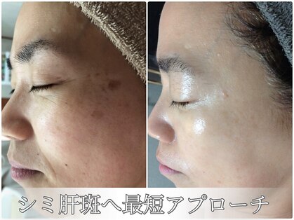 ルノン(LUNON)の写真