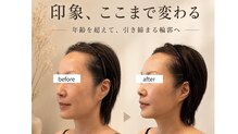 ポノティー(PONOTY)
