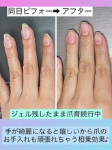 桃の木 吉祥寺店/自爪が弱いと折れるリスクが高い