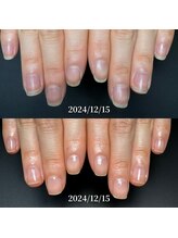 ココ(COCO)/お客様に寄り添う深爪改善