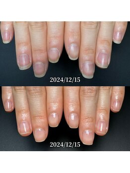 ココ(COCO)/お客様に寄り添う深爪改善