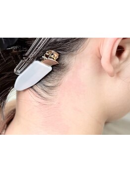 パーツ脱毛のできるサロン