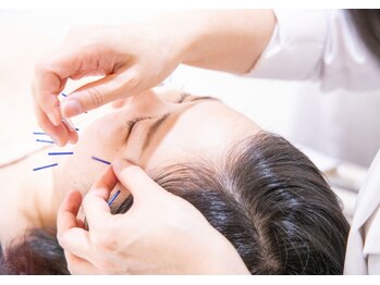 ハリリーナ 静岡(Haririna)の写真/【美顔鍼を初めて受ける方におすすめ】小顔鍼(30分)¥3,300!施術後は毎日鏡を見るのが楽しくなる☆