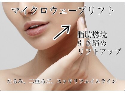 グラッソ(GRASSO)の写真